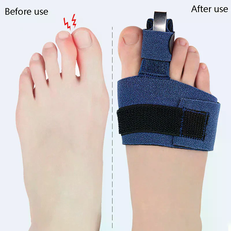 1Pcs Toe Corrector Toe Fractur - Ankle Brace Sock 评论和价格